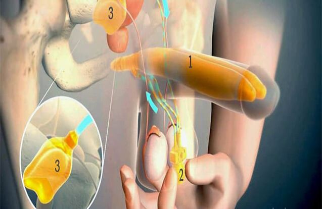 Operacija lipofilling